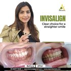 Tips on How You Can Find the Best Dentist